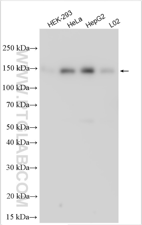 NCAPG2 Antibody in Western Blot (WB)