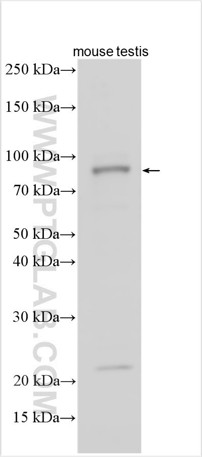 SEC24B Antibody in Western Blot (WB)