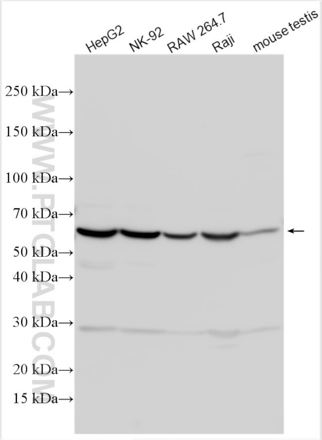 CCDC157 Antibody in Western Blot (WB)
