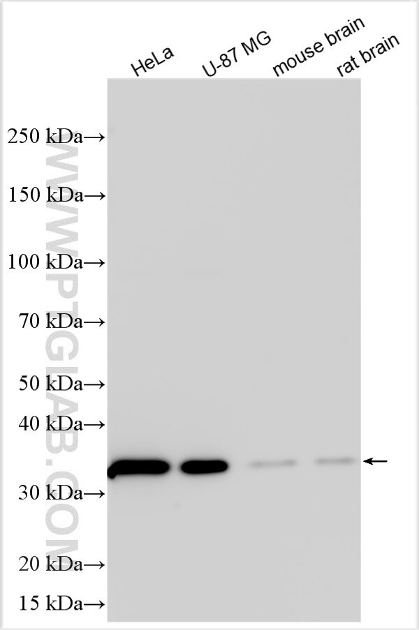 WNK3 Antibody in Western Blot (WB)