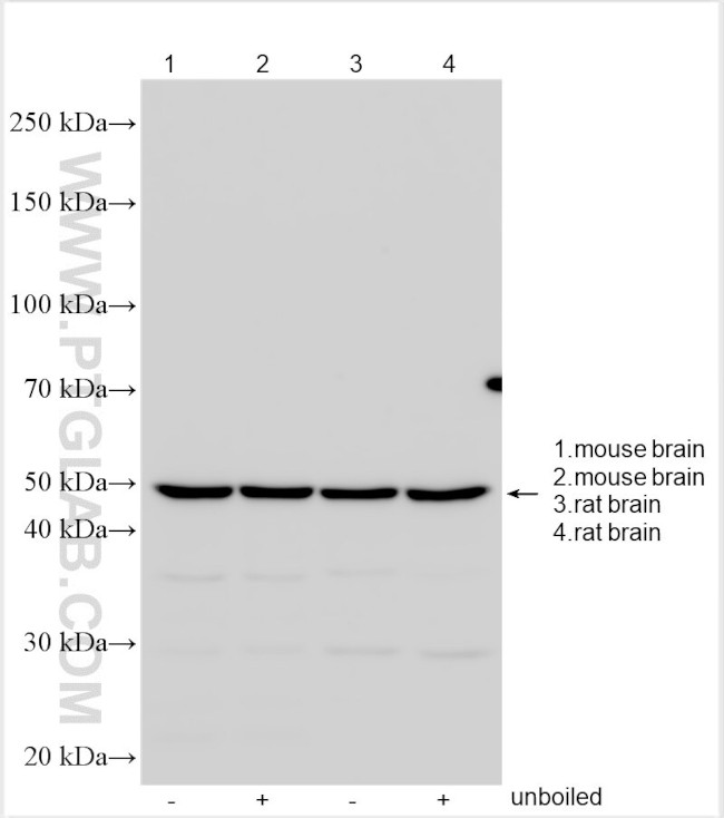 NACA Antibody in Western Blot (WB)