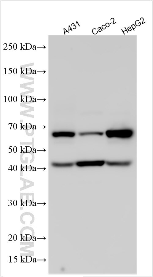FAM161A Antibody in Western Blot (WB)