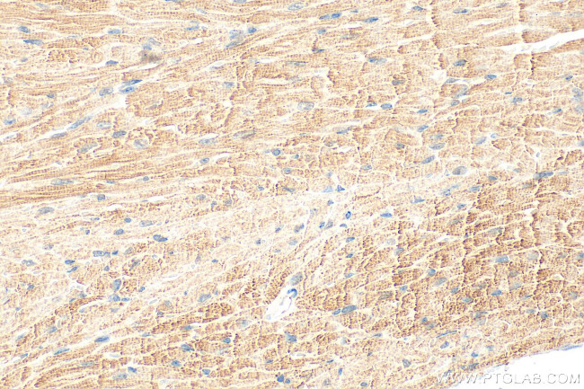 MYOM2 Antibody in Immunohistochemistry (Paraffin) (IHC (P))