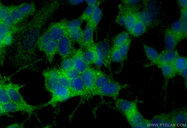 Proenkephalin-A Antibody in Immunocytochemistry (ICC/IF)