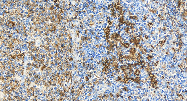 HLA-DQB1 Antibody in Immunohistochemistry (Paraffin) (IHC (P))