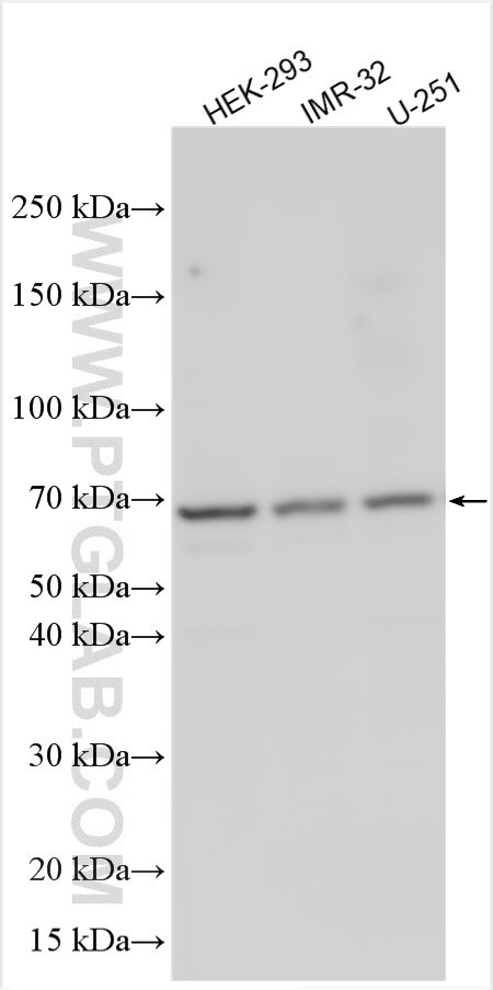 LRRC57 Antibody in Western Blot (WB)