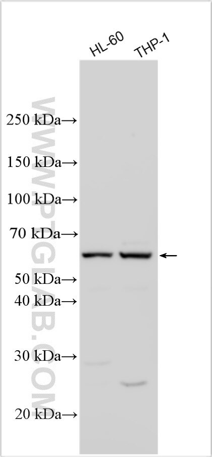 MOSPD1 Antibody in Western Blot (WB)
