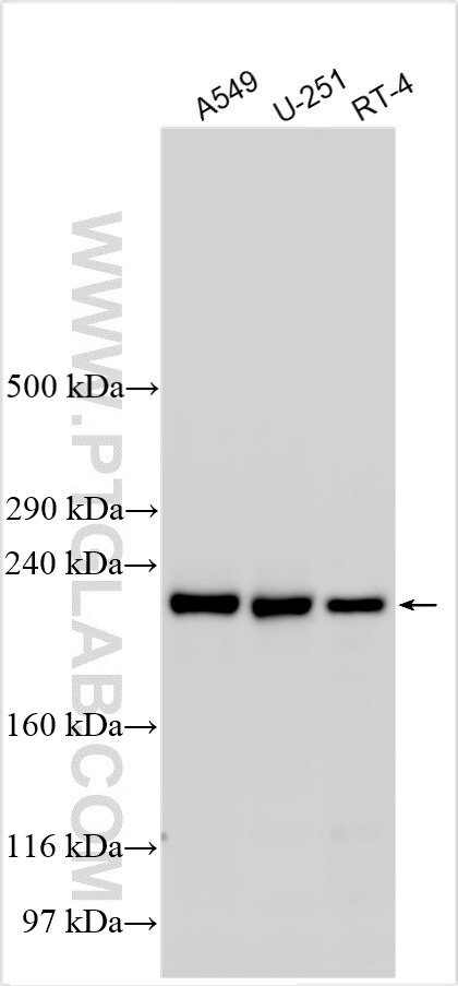 WDR17 Antibody in Western Blot (WB)