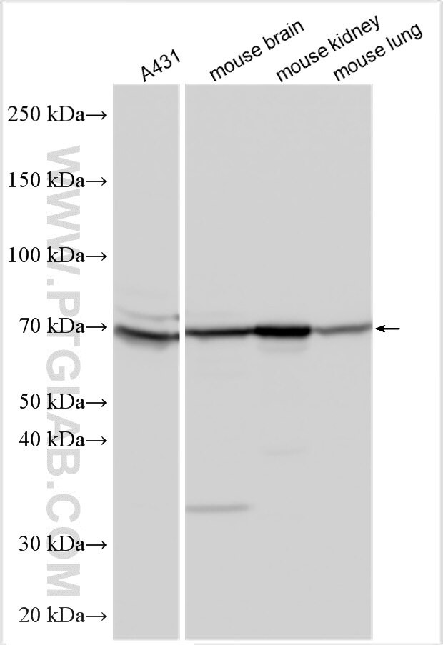 HEATR5B Antibody in Western Blot (WB)