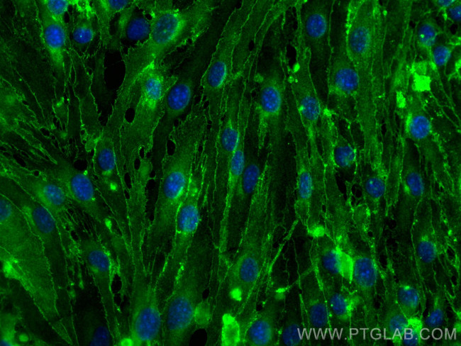 VE-cadherin/CD144 Antibody in Immunocytochemistry (ICC/IF)
