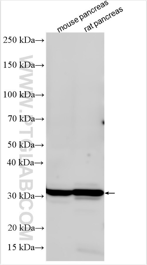 USP9Y Antibody in Western Blot (WB)