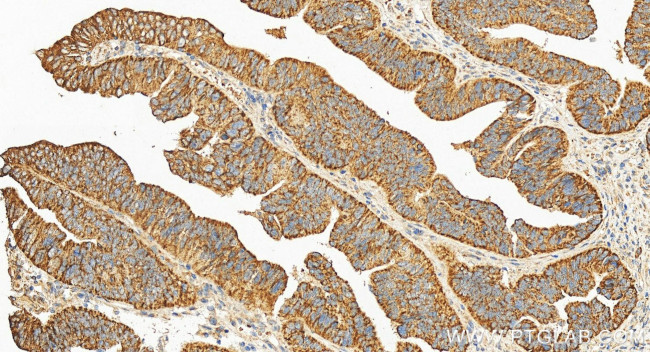 CARD10 Antibody in Immunohistochemistry (Paraffin) (IHC (P))