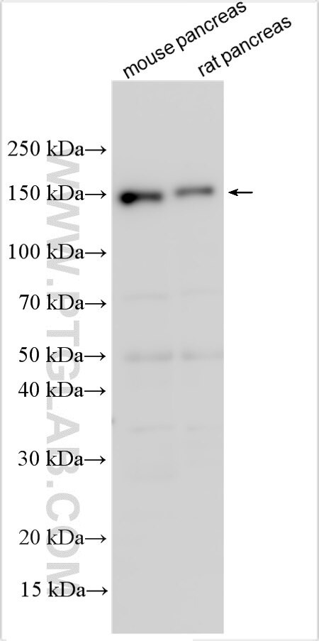 ELA3B Antibody in Western Blot (WB)