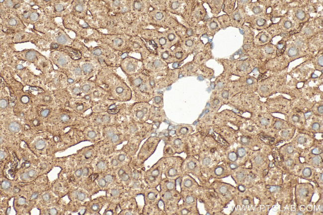 Transferrin Receptor 2/TFR2 Antibody in Immunohistochemistry (Paraffin) (IHC (P))