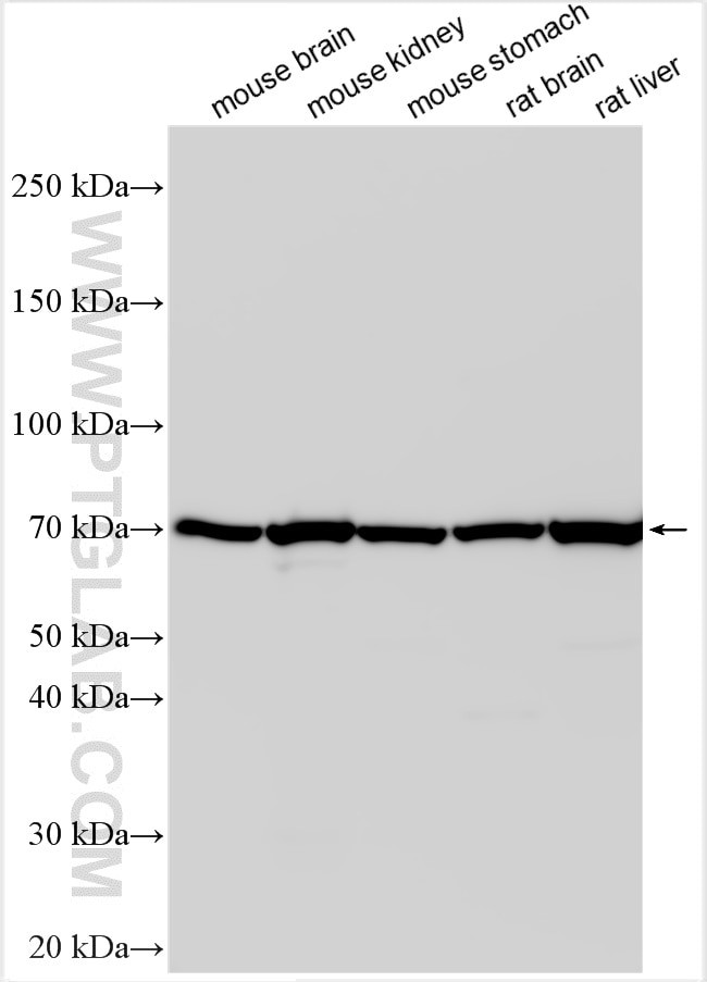 ARHGAP44 Antibody in Western Blot (WB)