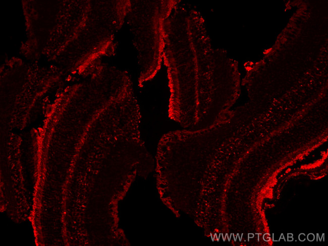 SLC7A11/xCT Antibody in Immunohistochemistry (Paraffin) (IHC (P))