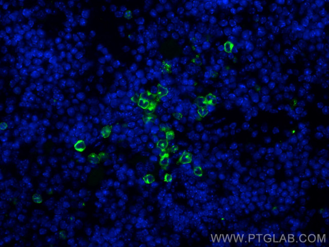 MPO Antibody in Immunohistochemistry (Paraffin) (IHC (P))