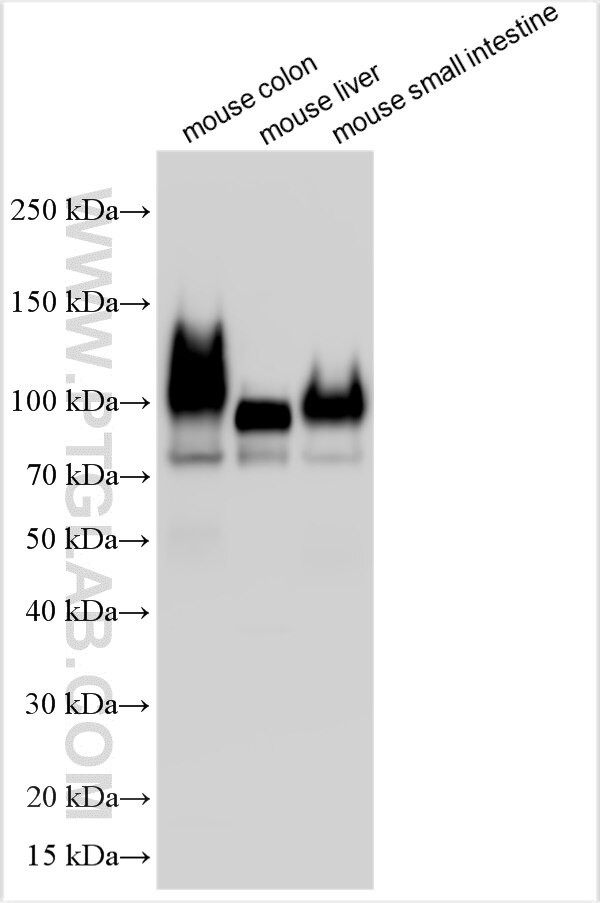 RBP4 Antibody in Western Blot (WB)