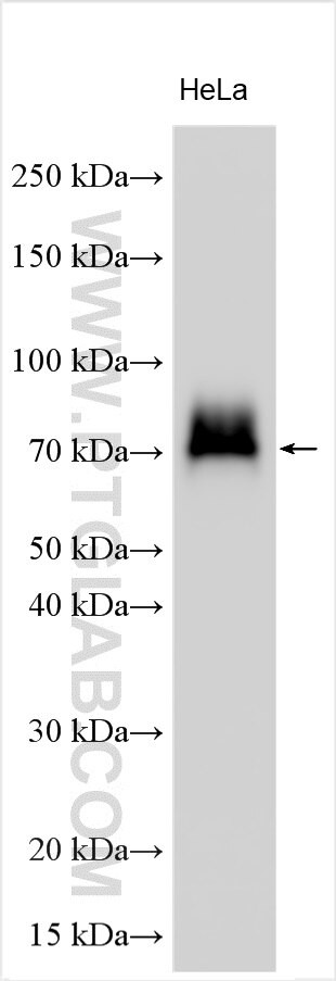 Fibrinogen gamma chain Antibody in Western Blot (WB)