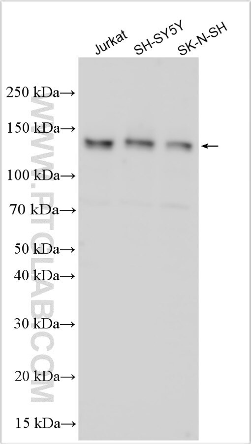 Ficolin 2 Antibody in Western Blot (WB)