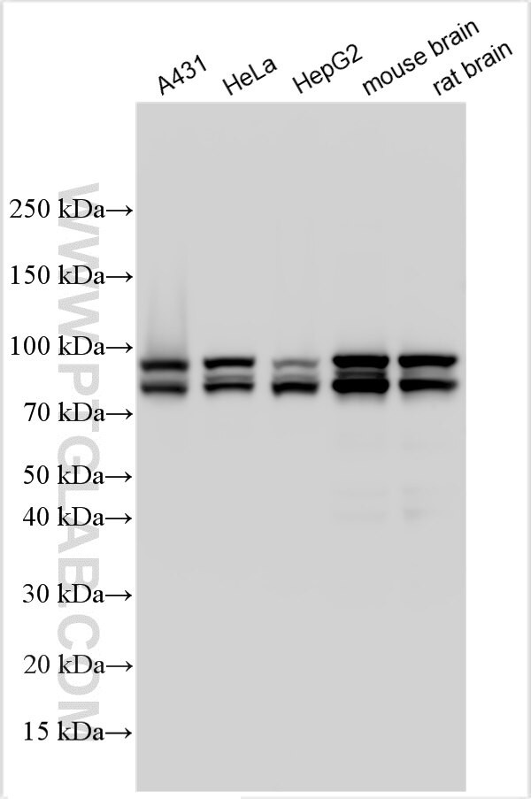 LCK Antibody in Western Blot (WB)