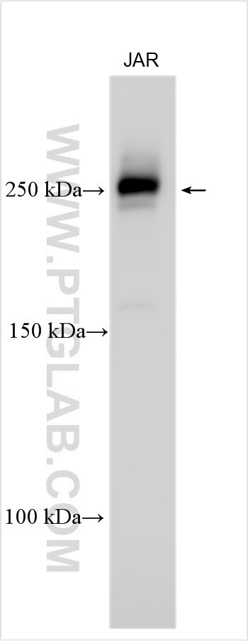 HSPA4L Antibody in Western Blot (WB)