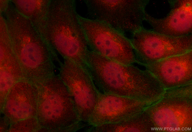 NUDCD1 Antibody in Immunocytochemistry (ICC/IF)