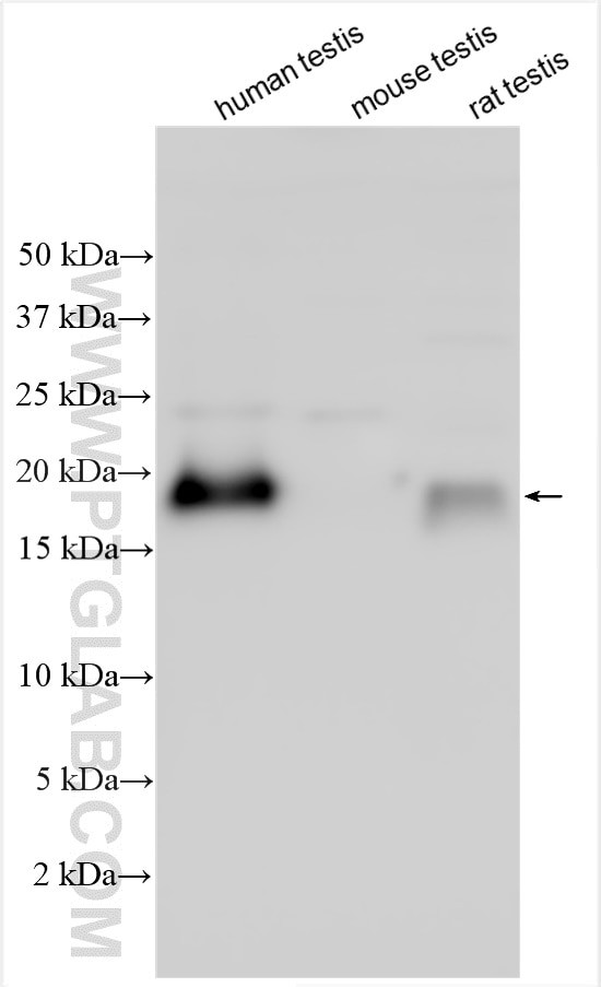 RNF220 Antibody in Western Blot (WB)