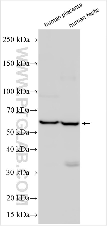 LELP1 Antibody in Western Blot (WB)