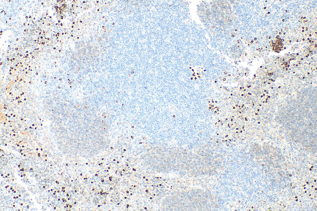 FceR1a Antibody in Immunohistochemistry (Paraffin) (IHC (P))