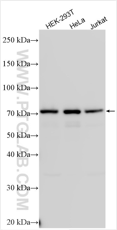 NGFR/TNFRSF16 Antibody in Western Blot (WB)