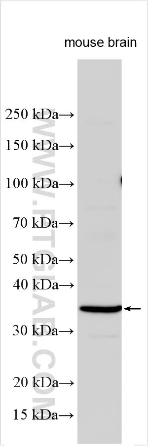 RANK/TNFRSF11A Antibody in Western Blot (WB)