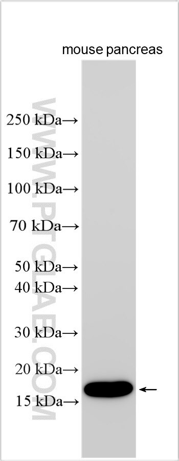 EPOR Antibody in Western Blot (WB)