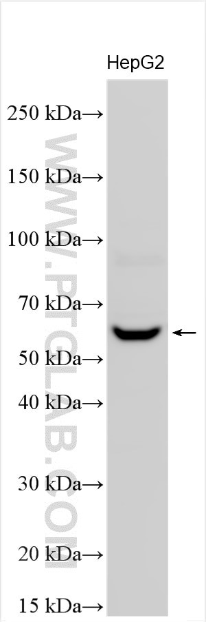 CD122/IL-2RB Antibody in Western Blot (WB)