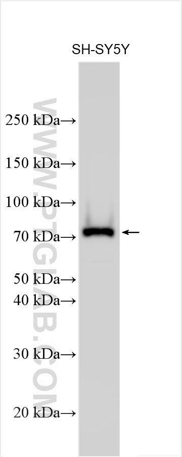 EPS8L3 Antibody in Western Blot (WB)