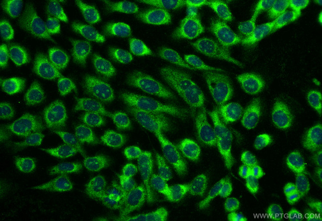 HSF2BP Antibody in Immunocytochemistry (ICC/IF)
