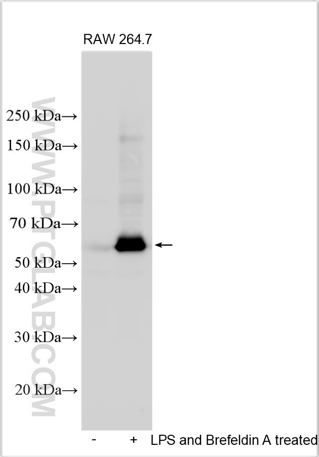 CTRB1 Antibody in Western Blot (WB)