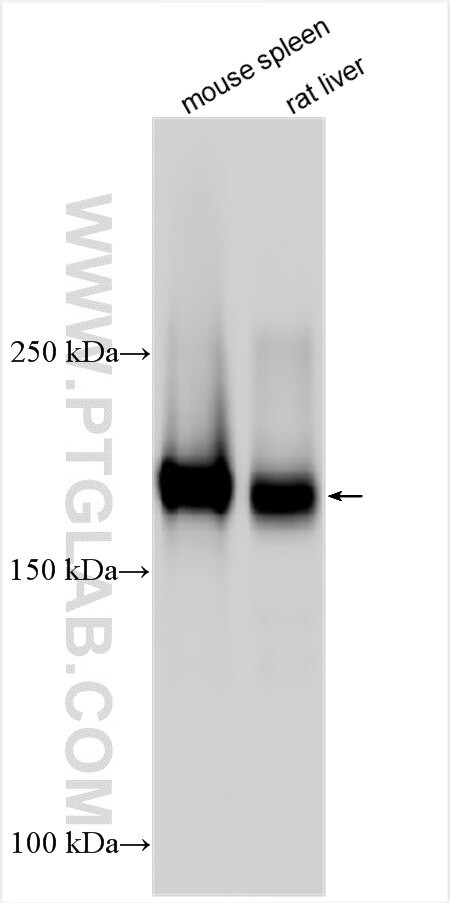 IL-1R2 Antibody in Western Blot (WB)