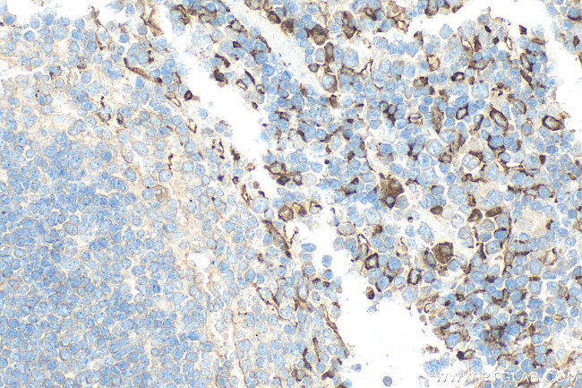 CD206 Antibody in Immunohistochemistry (Paraffin) (IHC (P))