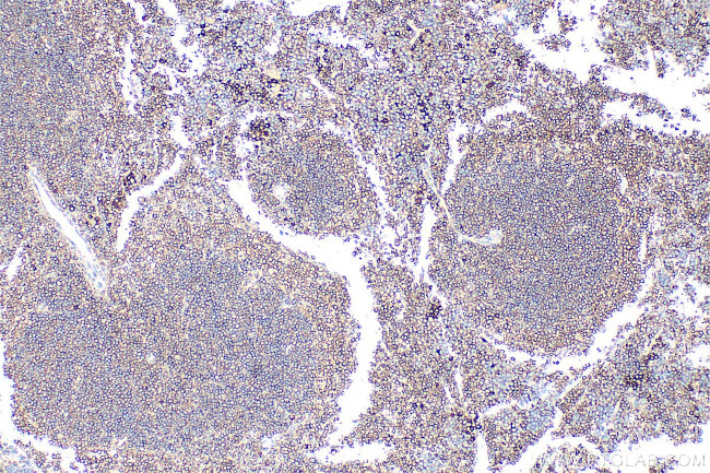 CD229/SLAMF3 Antibody in Immunohistochemistry (Paraffin) (IHC (P))