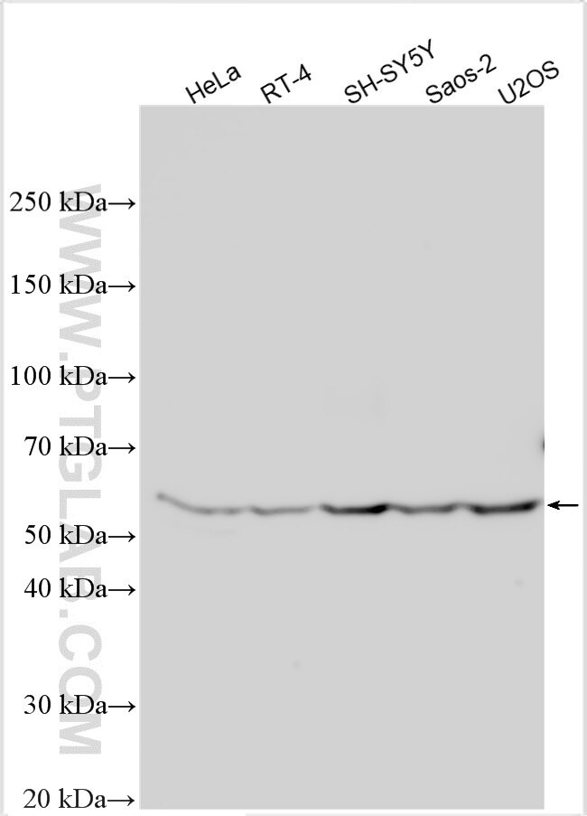F8A2 Antibody in Western Blot (WB)