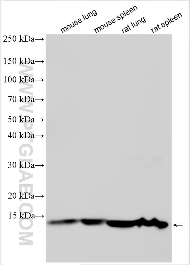 FAM171B Antibody in Western Blot (WB)