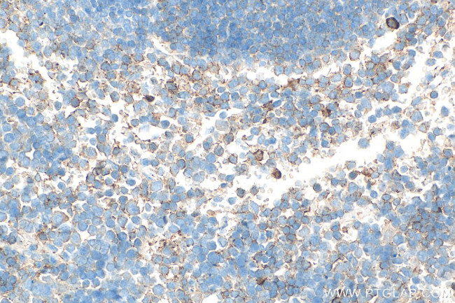 Tnfsf18 Antibody in Immunohistochemistry (Paraffin) (IHC (P))