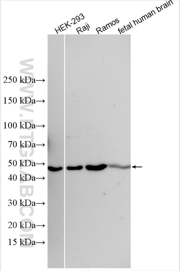 Beta-2-Microglobulin Antibody in Western Blot (WB)