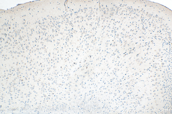 FAM76B Antibody in Immunohistochemistry (Paraffin) (IHC (P))