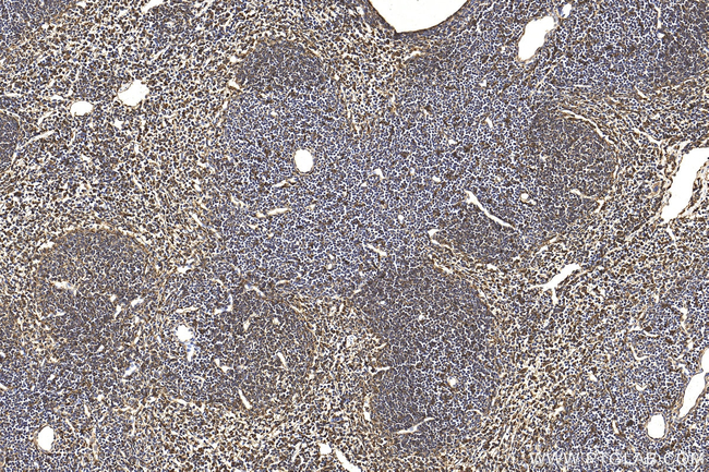 PSAP Antibody in Immunohistochemistry (Paraffin) (IHC (P))
