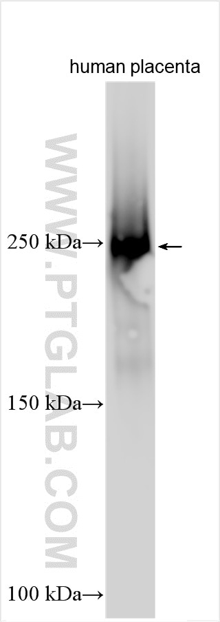PAPP A2 Antibody in Western Blot (WB)