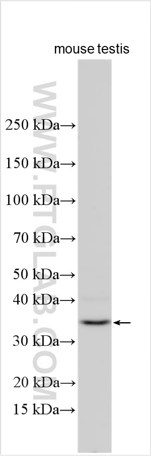 FAM166A Antibody in Western Blot (WB)
