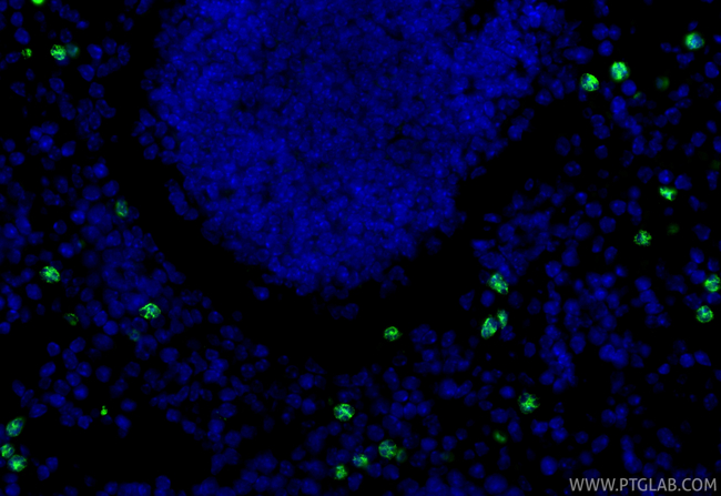 MMP8 Antibody in Immunohistochemistry (Paraffin) (IHC (P))