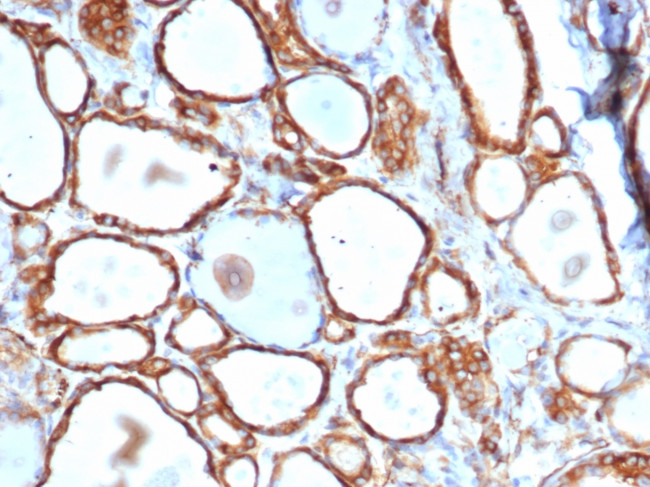 Heat Shock 27kDa Protein 1 Antibody in Immunohistochemistry (Paraffin) (IHC (P))